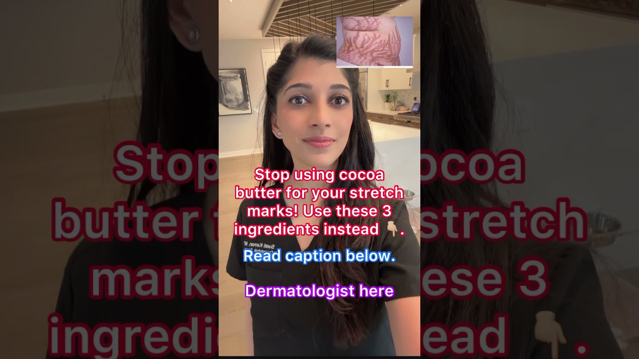 Cocoa Butter Isn’t Helping Your Stretch Marks. Use THIS 👇🏼Instead.