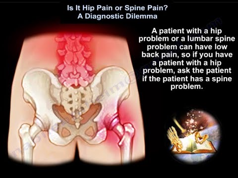 Ból biodra czy ból pochodzący od kręgosłupa - trudności diagnostyczne - Dr. Nabil Ebraheim