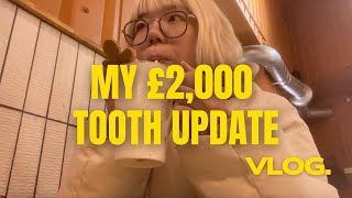 【ロンドン生活】絶望。歯医者の治療費が36万円!? 30代在宅ワークのリアルな家計事情