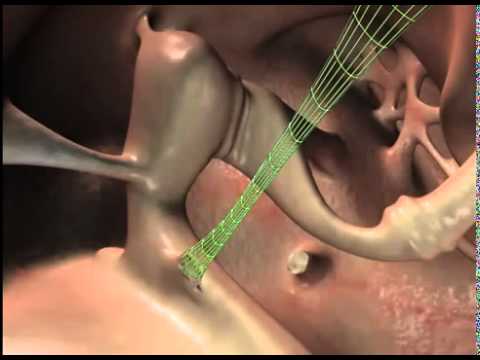 Ouvido Humano - Auditory Transduction 2002