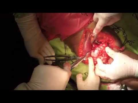 Spine Behandlung von Dysplasie Psychische Störungen in Osteochondrose