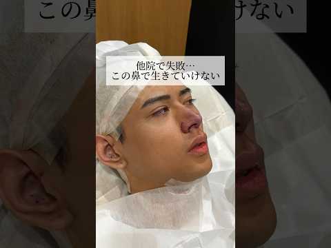 【鼻整形】他院で失敗...#shorts