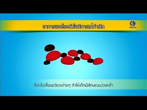 หัวใจพิการแต่กำเนิด