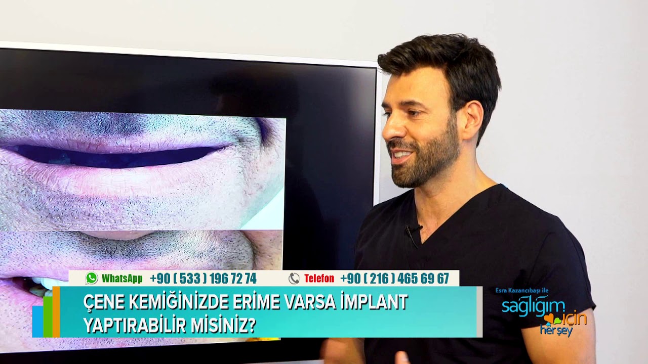 Diş Eksikliğinde Uygulanan İmplantlar