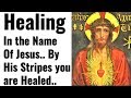 Miracle Healing Prayer In Jesus Name Healing Of Physical Ailment Mental Binding Virus Epidemics