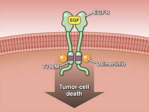 Osimertinib in Advanced Non–Small-Cell Lung Cancer