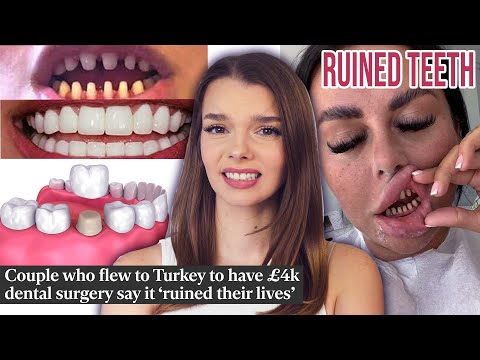 the truth about turkey teeth
