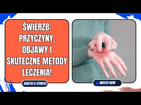 Świerzb: Przyczyny, objawy i skuteczne metody leczenia!