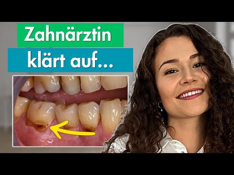 So sehr schadet Fluorid dir wirklich! (kaum bekannt)