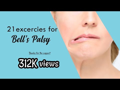 image-What is the fastest way to cure Bell's palsy?