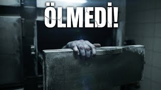 Tıp Dünyasını Şoke Eden Mucize