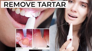 HOW TO REMOVE PLAQUE TARTAR AT HOME | Ultrasonic Tooth Cleaner Review - Does It Work?!