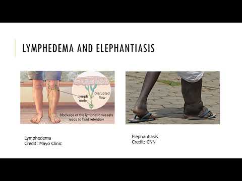 Chapter 21 Recorded Lecture