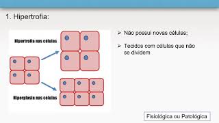 Distúrbios do crescimento e diferenciação celulares - Patologia geral (1/6)