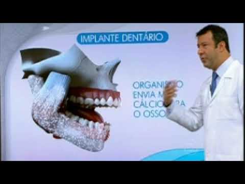 Bem Estar - Implante Parte 2