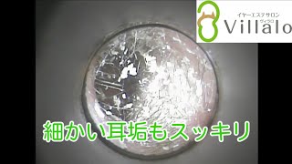 耳掃除動画vol.68「細かい耳垢もスッキリ」
