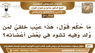 [217 -521] ما حكم قول: هذا عيبٌ خَلقي لمن ولد وفيه تشوه في بعض أعضائه؟