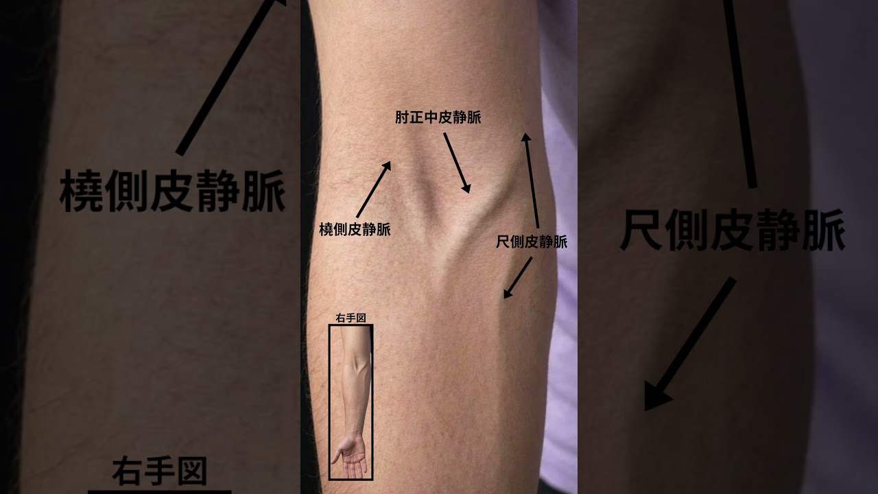 採血するならどれ選ぶ？#採血 #shorts