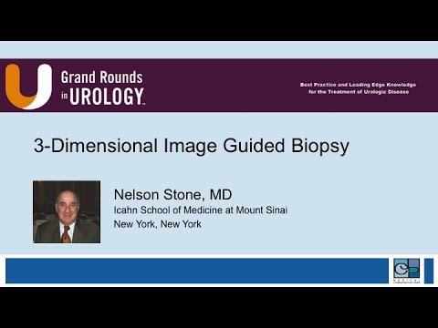 3-Dimensional Image Guided Biopsy