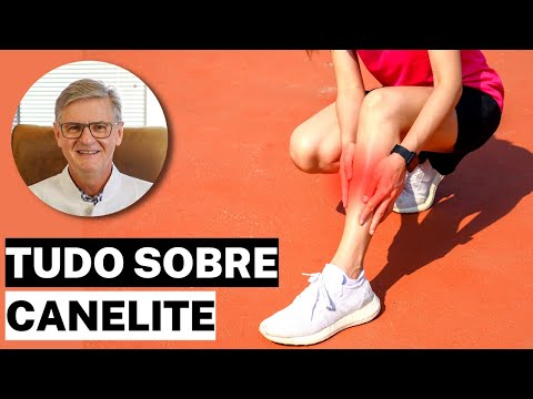 DOR NA CANELA | O que é Canelite (Sintomas, Diagnóstico e Tratamento)