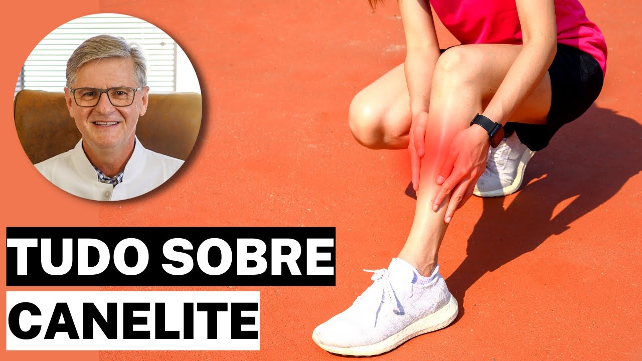 DOR NA CANELA | O que é Canelite (Sintomas, Diagnóstico e Tratamento)