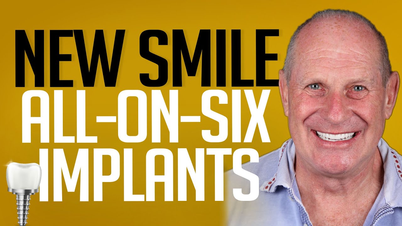 UK Patient’s Smile Restoration in Istanbul | Implants, Crowns & Confidence