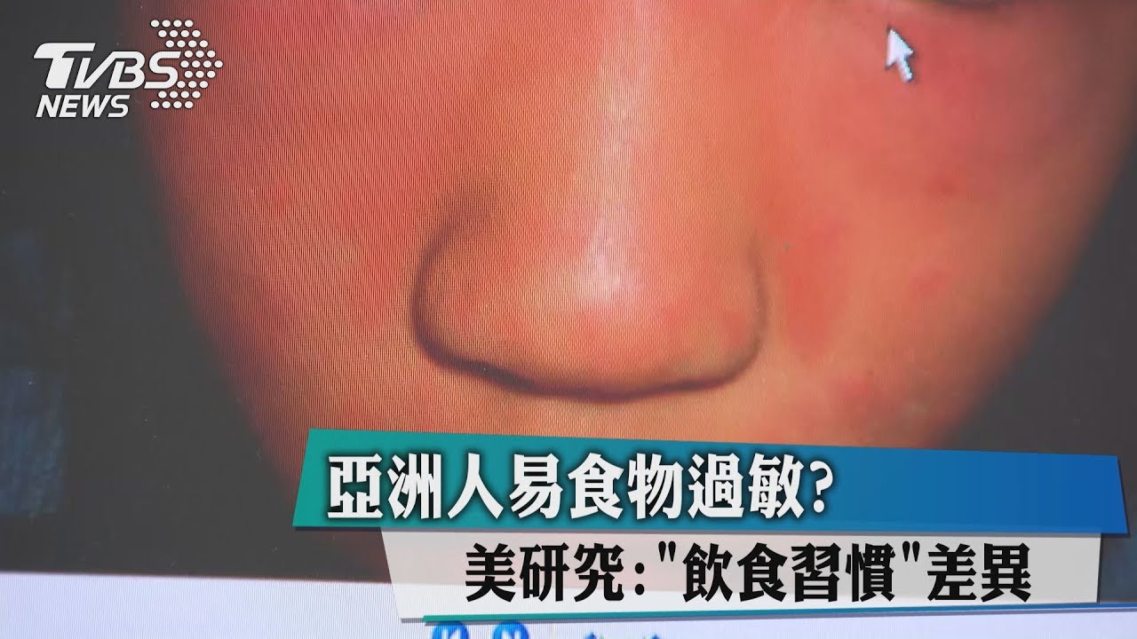 亞洲人易食物過敏？　美研究：飲食習慣差異