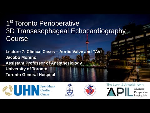 7 Moreno - Cases: AV TAVI. Toronto Perioperative 3D TEE Course 2019