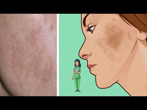 Keni më shumë se 10 lytha në trup? Ja përse duhet të jeni të lumtur!