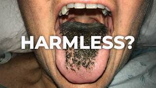 Your Tongue Isn’t Dirty… Here’s What’s Actually Happening