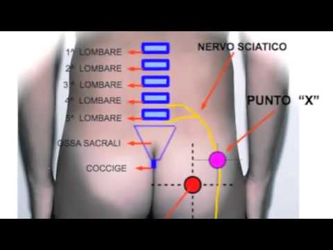 Esercizio durante lallattamento al lombare osteocondrosi Come sbarazzarsi di dolore alle articolazioni della spalla