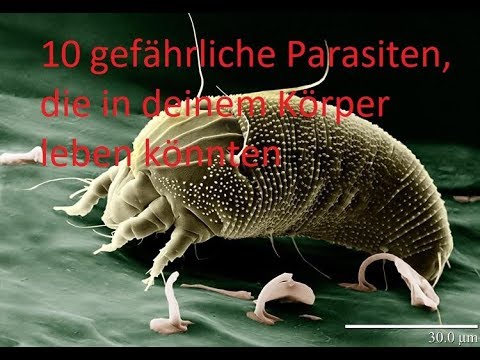 TOP 10 2018 gefährliche Parasiten, die in deinem Körper leben könnten