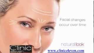 preview picture of video 'Clinic Eleven Upper Facial Lines video'