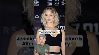 Jennifer Lawrence before and after plastic surgery. #jenniferlawrence #plasticsurgeon #celebrity