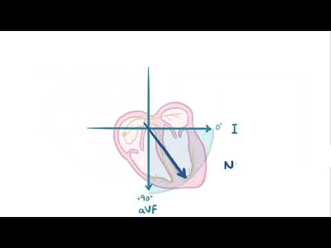 ECG Axis by osmosis