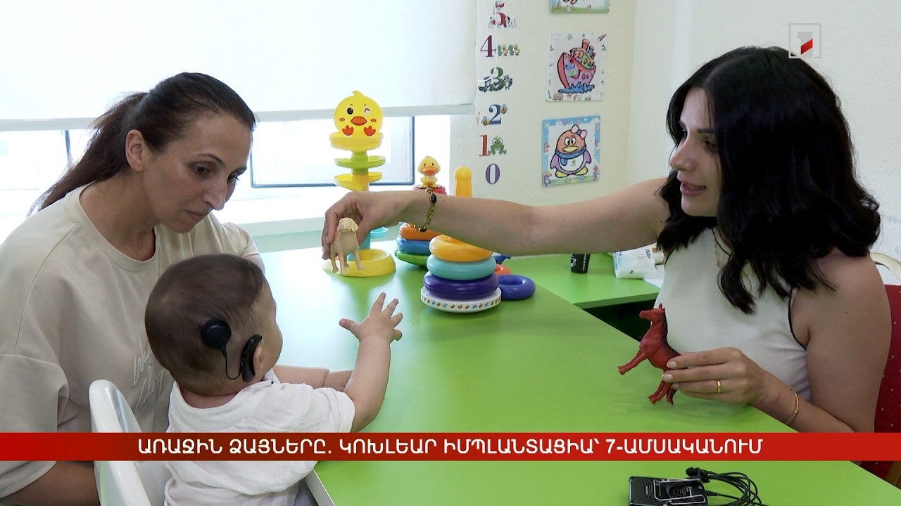Առաջին ձայները. կոխլեար իմպլանտացիա՝ 7-ամսականում