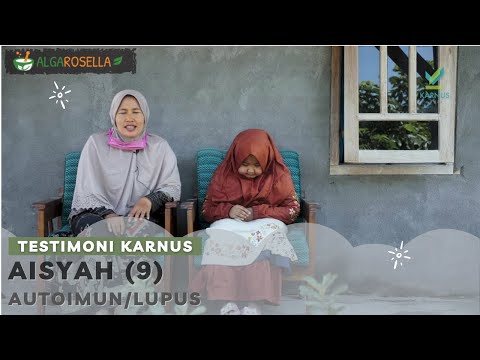 Divonis Lupus, Sembuh Total Dalam 1 Tahun dengan Alga Series