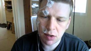 Bells Palsy Treatment - Using Trophic Electrical Stimulation