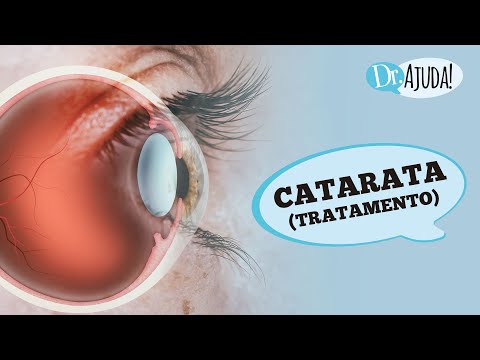 CATARATA: O QUE É? SINTOMAS, DIAGNÓSTICO E TRATAMENTO