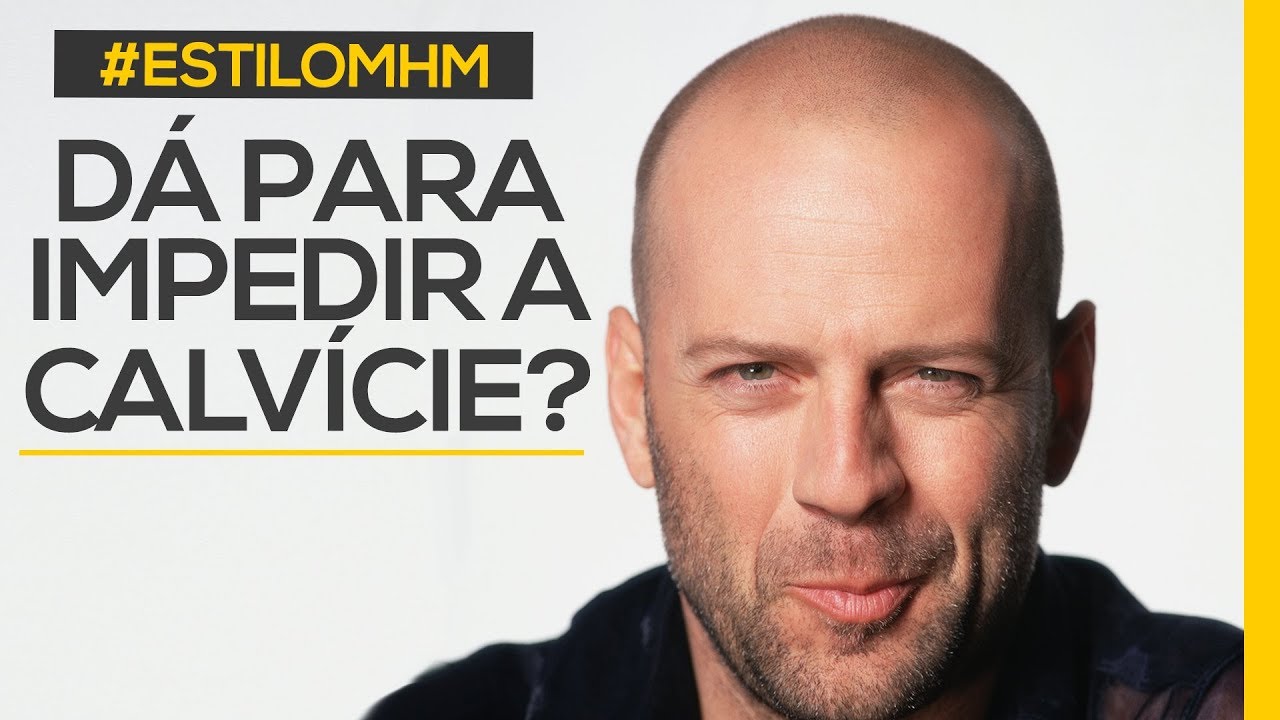 Dá pra parar calvície? 10 dicas para não se tornar um careca