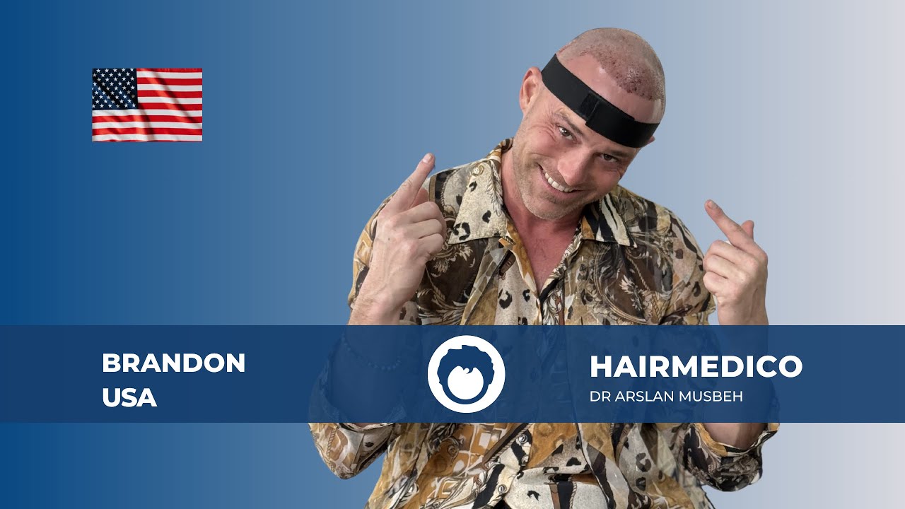 Before & After — FUE Hair Transplant Result