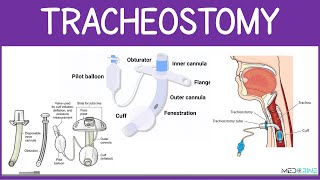Tracheostomy Tubes: Types, Components, Nursing and Respiratory care Interventions Explained