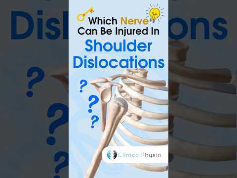 Anterior Shoulder Dislocations can affect which nerve? #physicaltherapy #physiotheraphy #anatomy