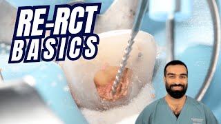 Simple Re-RCT Cases - 'How To' Guide - PDP233