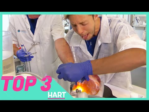ELBERT OPEREERT EEN HART - TOPDOKS TOP 3 VIDEOS - TOPDOKS