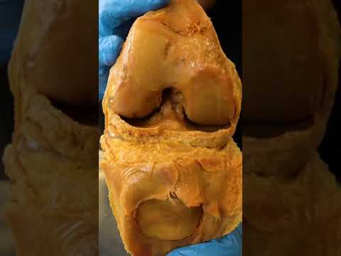 Inside of a Real Human Knee