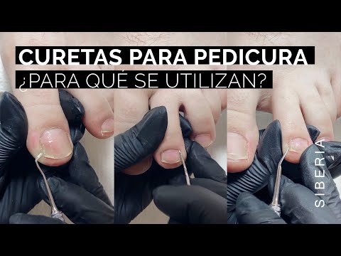 Curetas para Pedicura profesional🦶 para qué se utilizan y técnica de uso