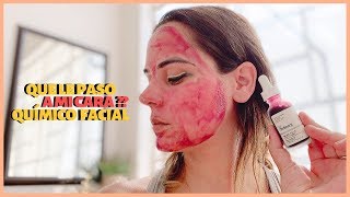 THE ORDINARY PEELING / MI EXPERIENCIA CON UN PEELING EN CASA SKINCARE