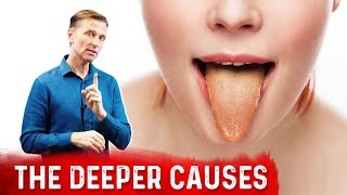 What Causes the Tongue to Change Colors?