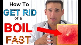 How to get RID of a Boil FAST at Home (3 STEPS) | Quickest Way to GET RID of a BOIL